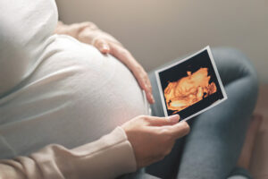 4Dエコー写真を持つ妊婦さん